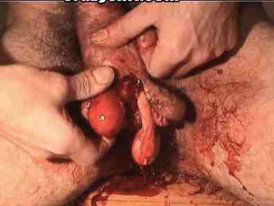 061108_genital_mutilation.jpg