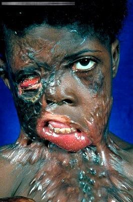 12266-horrific-afflictions-these-poor-africansbig1.jpg