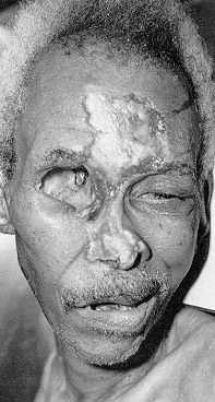 12266-horrific-afflictions-on-these-poor-africansbig14.jpg