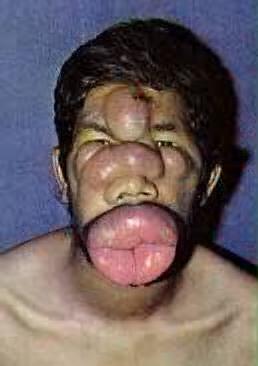 12266-horrific-afflictions-on-these-poor-africansbig15.jpg