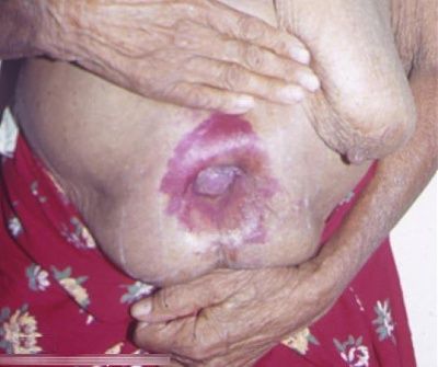 12266-horrific-afflictions-these-poor-africansbig7.jpg