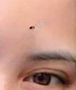Name:  mole.jpeg
Views: 140
Size:  6.4 KB