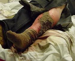 maggot%20leg.jpg
