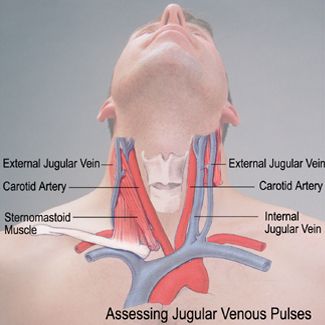Jugular%20Carotid%2001.jpeg