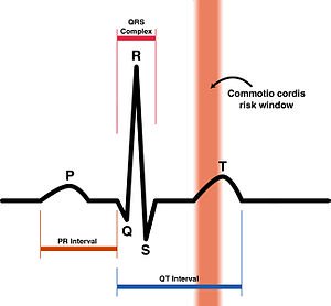 300px-Commotio_Cordis_Risk_Zone.jpg