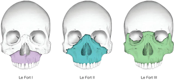 Name:  download.png
Views: 411
Size:  80.3 KB