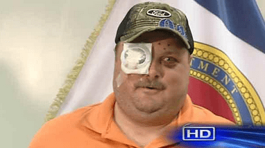 eye.png