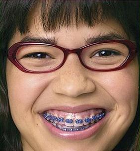 uglybetty.jpg