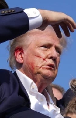 Name:  TRUMP_injury.jpeg
Views: 151
Size:  15.0 KB
