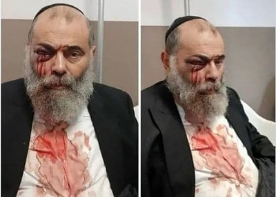 french.jew.attack.jpg