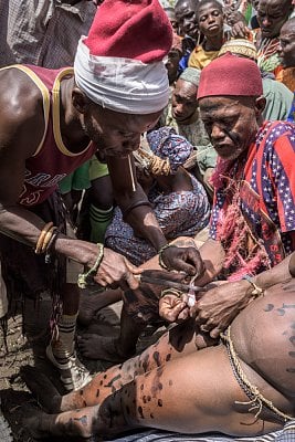 circumcision.jpg