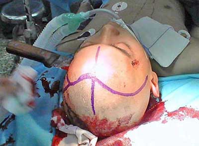 knife-in-head.jpg
