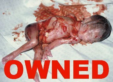 OWNED_abortion.jpg