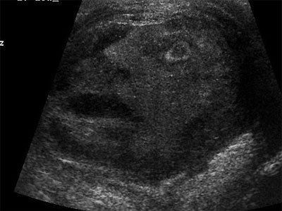 testicle_400_17b38pe-17b38pf.jpg