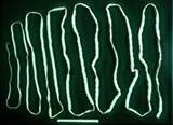 tapeworms.jpg