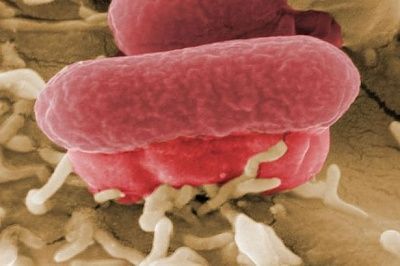 e_coli-1259541.jpg
