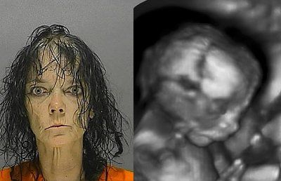 babyinass.jpg