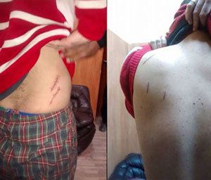 Name:  van-der-sloot-stabbed.jpg
Views: 3257
Size:  20.0 KB