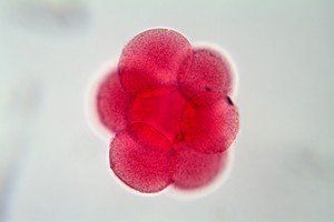 Name:  egg-cell-under-microscope.jpg
Views: 217
Size:  7.0 KB