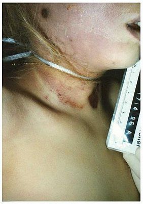 457e58d3c0099fad35ed2e413e844f94-jonbenet-ramsey-case-autopsy.jpg