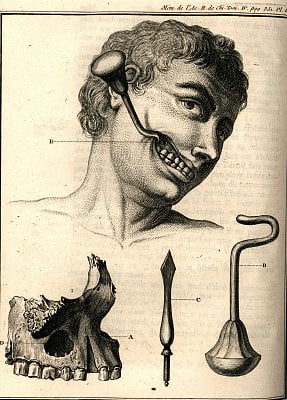memoires-20acadamie-20maxilla-20hook.jpg