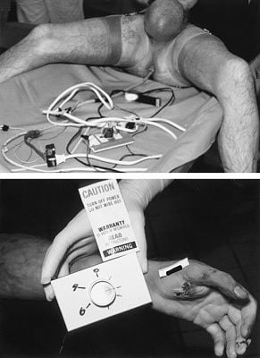 anal-implementation.jpg