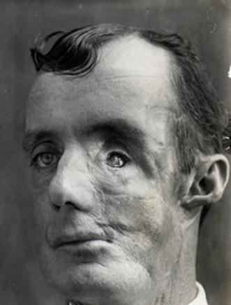 ped6_201.jpg