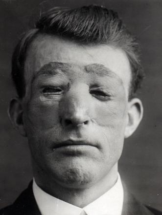 ped69_635.jpg