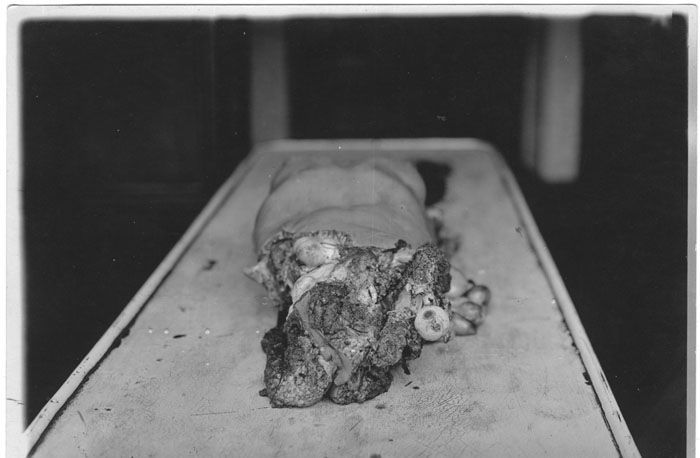 dismemberment-5.jpg