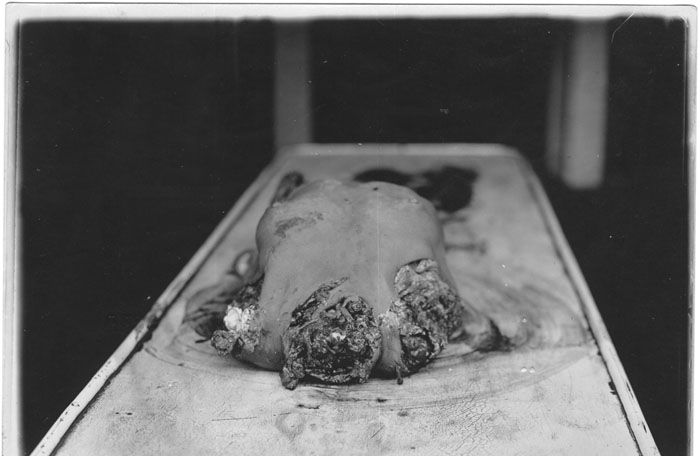 dismemberment-7.jpg