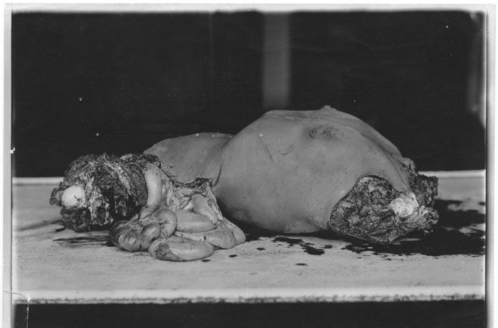 dismemberment-8.jpg
