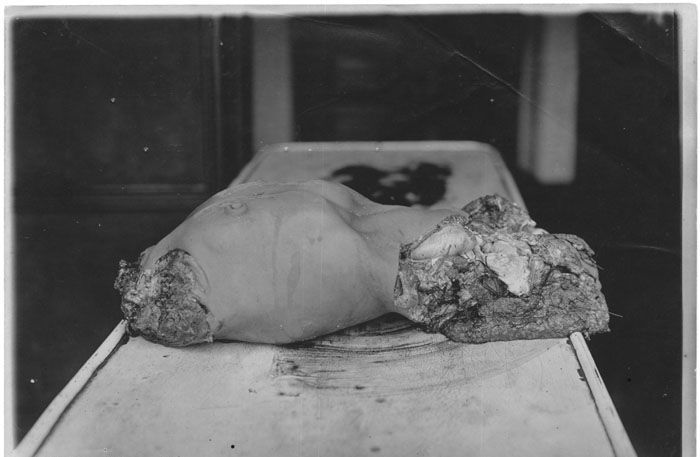 dismemberment-9.jpg