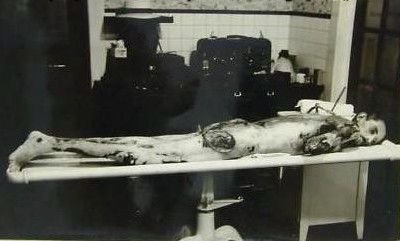 autopsy_post_mortem_1930s_man_0100.jpg