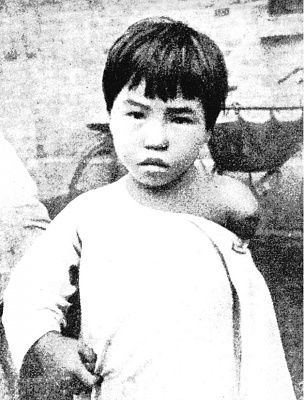 child-arm-gone.jpg