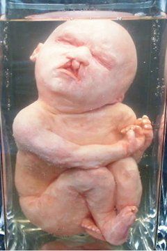pickledfetus8374yrg.jpg