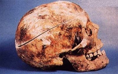 skull.jpg