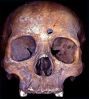 skull3.jpg