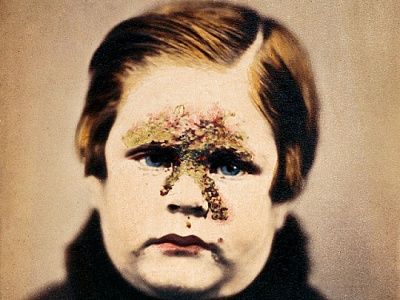 03_the_burns_archive_impeti_540x405.jpg
