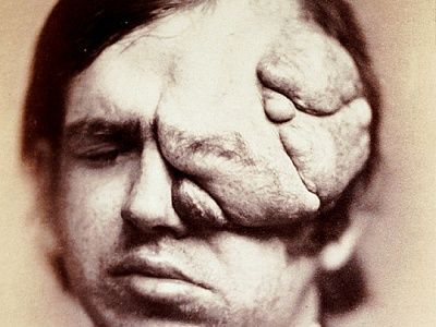 07_the_burns_archive_nerofi_540x405.jpg