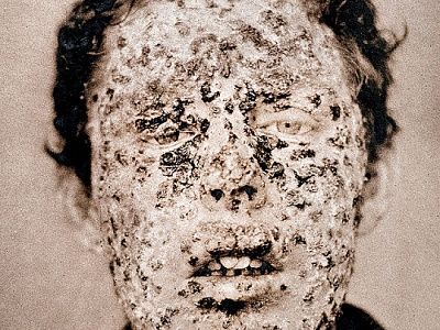 08_the_burns_archive_smallp_540x405.jpg
