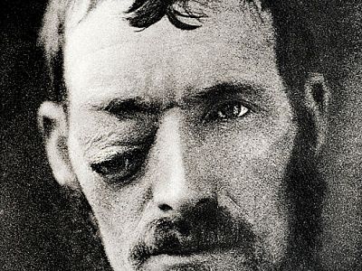 09_the_burns_archive_orbita_540x405.jpg