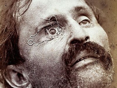 14_the_burns_archive_surger_540x405.jpg