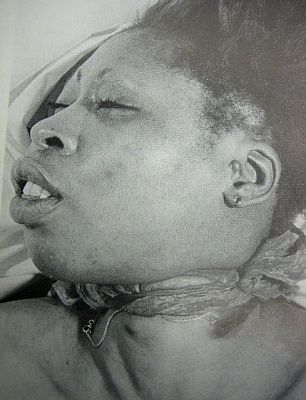 strangled.jpg