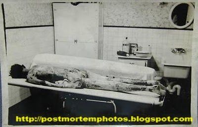another_vintage_autopsy_photo-POST.jpg