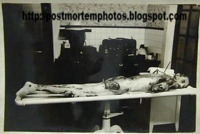 autopsy_post_mortem_1930s_man_0100.jpg