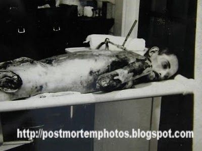 autopsy_post_mortem_1930s_man_0200.jpg