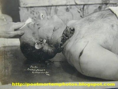 vintage_autopsy_pic-POST.jpg