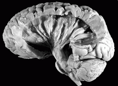 brain1.gif