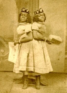 siamese%20twins.jpg
