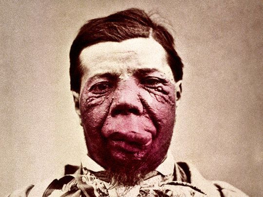 Burns_Archive_006_540x405.jpg